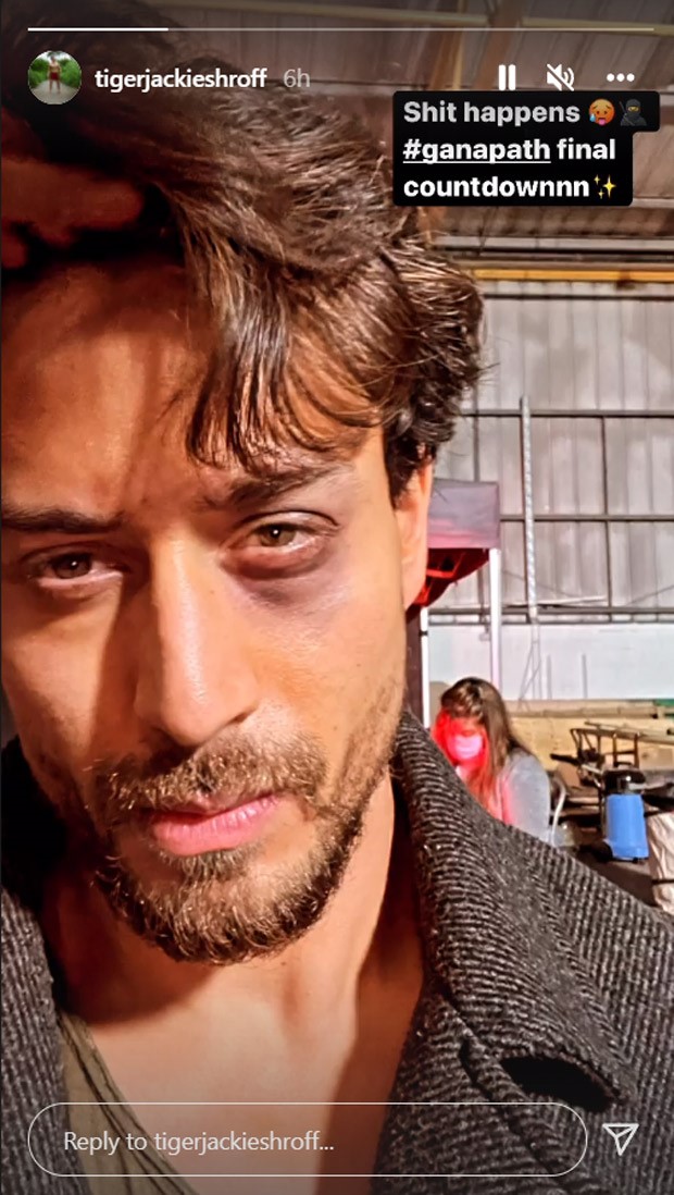 Tiger Schroeder injured in the eye during filming of Ganapath in the UK, photo shared