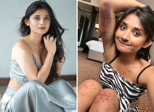 Khatron Ke Khiladi 12 contestant Kanika Mann gets bruised on the sets